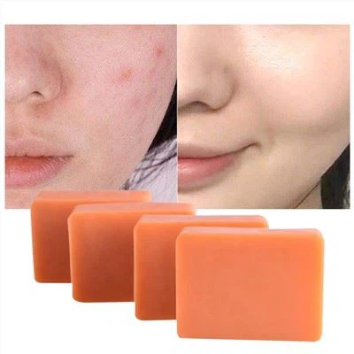 Sebon Bar Glanhau Asid Kojic
